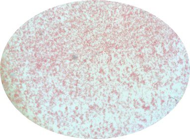 Capnocytophaga canimorsus Gram Stain