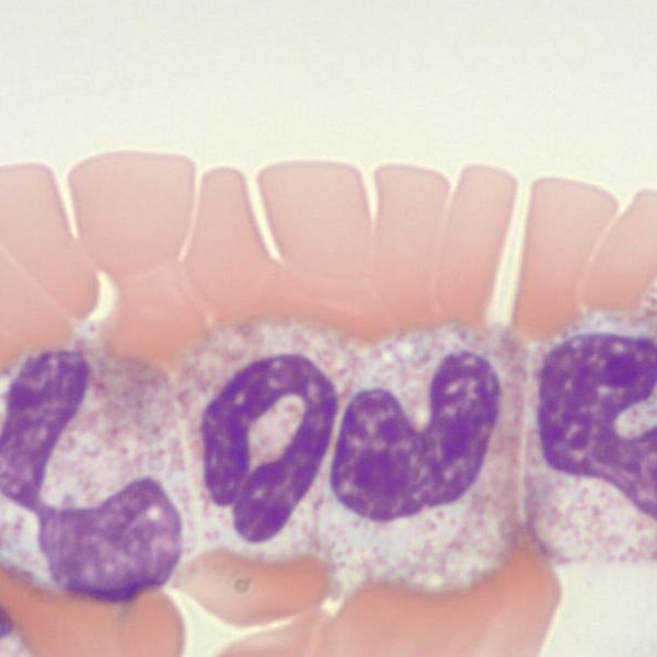 Slide that spells LOVE - 2023 Lab Week Photo Contest Winner